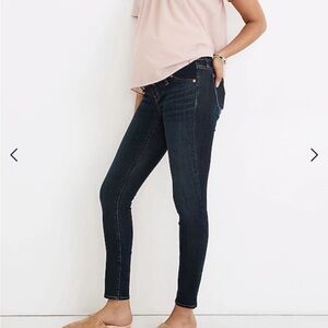 Madewell Dark Blue Skinny Jeans